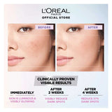 L'Oreal Paris Glycolic Bright Instant Glowing Serum, Reduces 57% Dark Spots, 15ml, Oils & Serums, Loreal, Chase Value