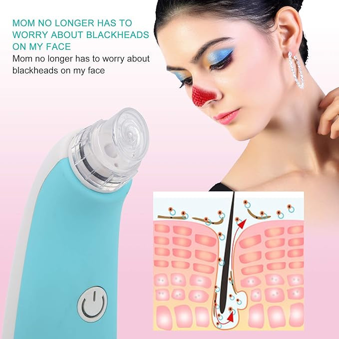 Black Head Cleaners & Remover Z1 - Cyan, Skin Treatments, Chase Value, Chase Value